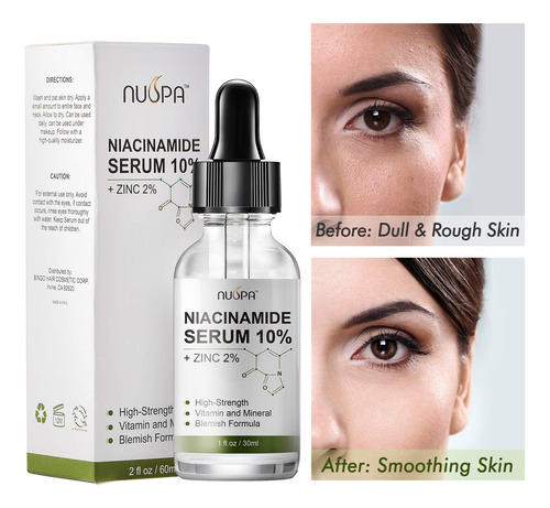 Sérum De Vitamina C Orgánica Nuspa Para Rostro, Cuello Y Ojo
