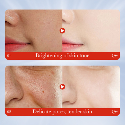 Mascarilla Para Dormir Calmante Blanqueadora Con Tretinoína