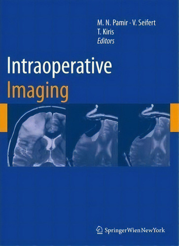 Intraoperative Imaging, De M. Necmettin Pamir. Editorial Springer Verlag Gmbh, Tapa Blanda En Inglés