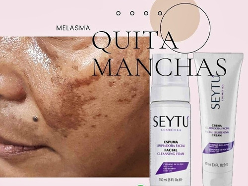 Imagen 2 de 2 de Kit Para Manchas Facial