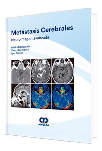 Metástasis Cerebrales. Neuroimagen Avanzada. Libro Amolca.