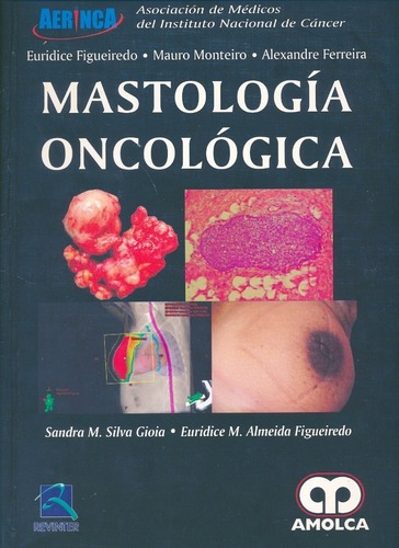 Mastología Oncológica - Monteiro / Almeida / Figueir, De Monteiro / Almeida / Figueiredo. Editorial Amolca En Español