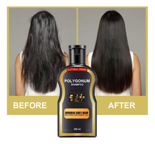 Champú Hidratante Antigrasa Polygonum Multiflorum Anti