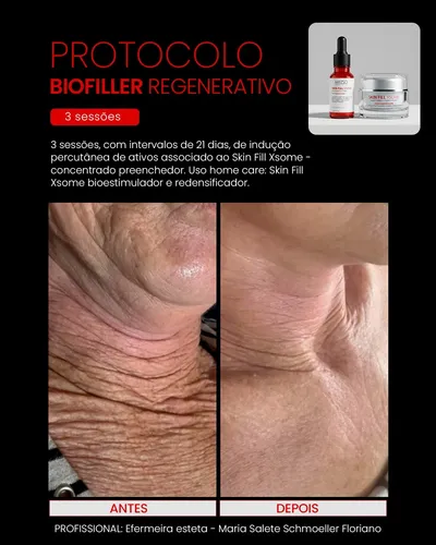 ghk-cu antes e depois Bom dia! Boa tarde! Boa noite! Falando de estética, o é simplesmente o melhor peptídeo já estudado até agora. Ainda está em fase de estudo. Ele atua no corpo inteiro quando o assunto é beleza: ✨ Sua pele pode voltar