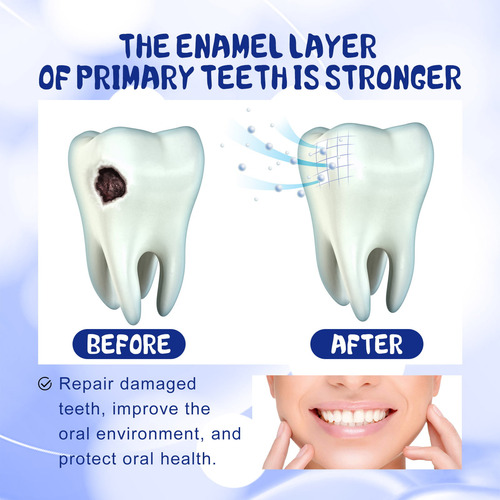 Pasta De Dientes Para Reducir La Caries Para La Limpieza Buc