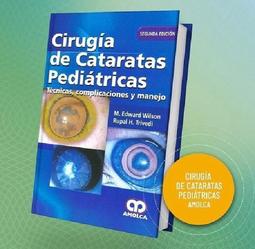 Libro - Cirugía De Cataratas Pediátricas  2 Ed. Técnicaspli