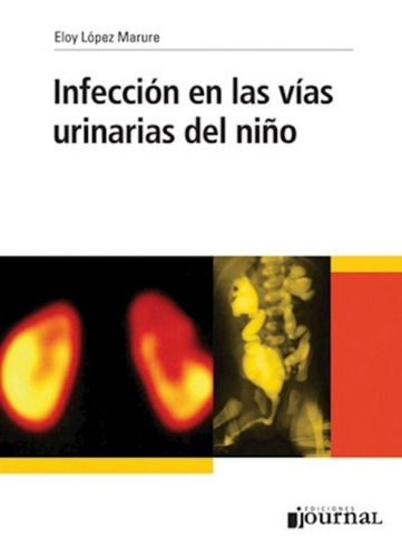 Infección En Las Vías Urinarias Del Niño. López Marure