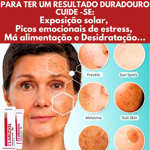 Melhor Clareador Para Melasma 2025 Clareador de Pele Melasma