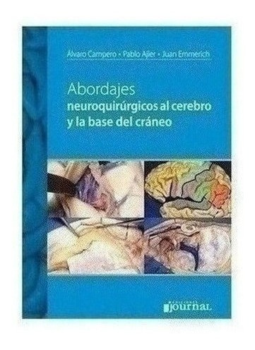 Abordajes Neuroquirúrgicos Al Cerebro Y La Base Del Cráneo