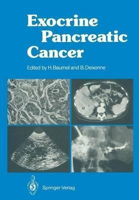 Exocrine Pancreatic Cancer - H. Sarles (paperback)