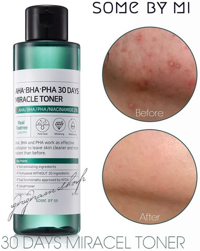 Loção 30 Days Miracle Toner Some by Mi de 150mL