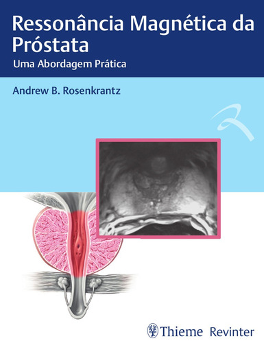 Ressonância Magnética da Próstata: Uma abordagem prática, de Rosenkrantz, Andrew B.. Editora Thieme Revinter Publicações Ltda, capa dura em português, 2018