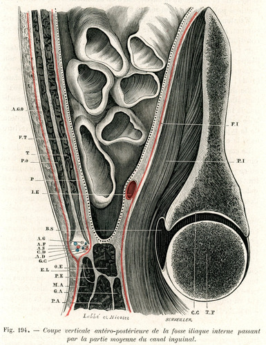 Grabado Antiguo Medicina Sección Vertical De La Fosa Ilíaca