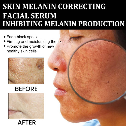 L Melanin Facial Repair Hidrata La Piel, Blanquea Y Decolora
