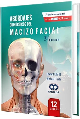 Libro Abordajes Quirúrgicos Del Macizo Facial De Edward Elli