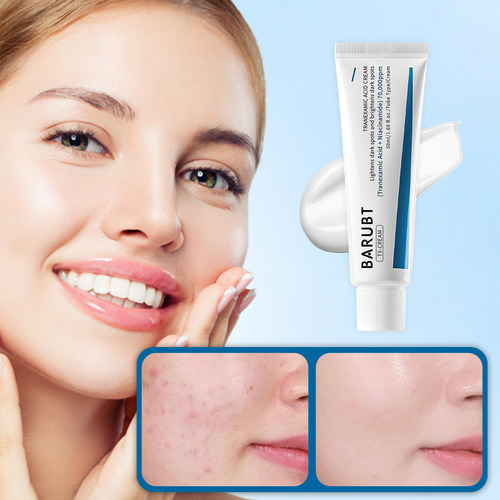 Ae Crema For Pecas Con Ácido Tranexámico