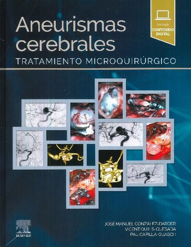 Libro Aneurismas Cerebrales. Tratamiento Microquirúrgico De