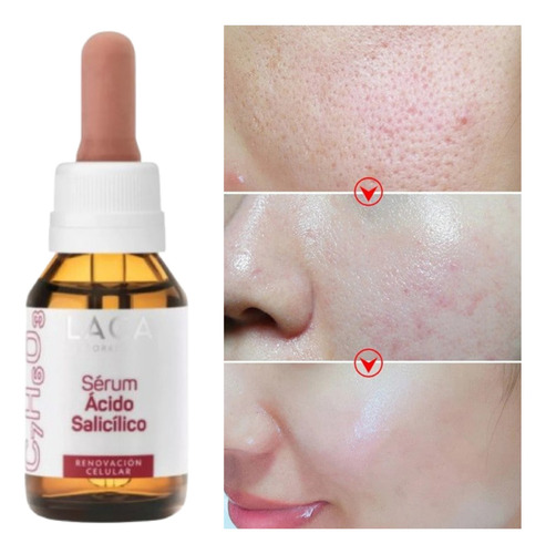 Serum Ácido Salicílico 2% Piel Grasa Reduce Poros Laca Grasa Noche