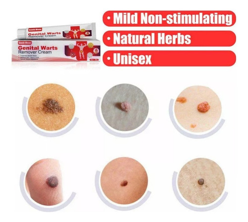Pomada Para Remover Verrugas De Herpes Genital, 20 G* 2