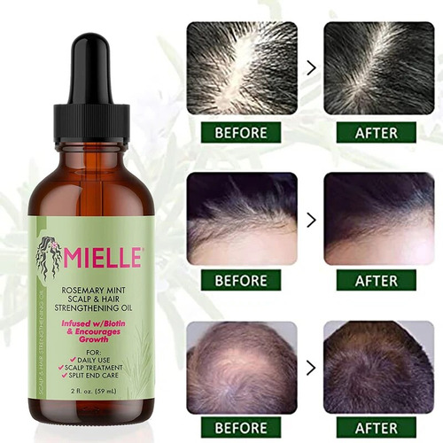 Aceite Fortalecedor De Menta Para El Cabello Mielle Y Romero