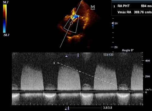 Imagen 6 de 10 de Ecodoppler Cardiaco, Doppler Vascular, A Domicilio