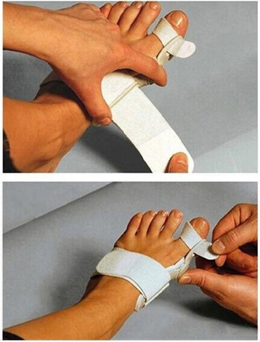 Imagen 5 de 6 de Ferula Correctora Hallux Valgus (juanete), Corrige Dedos Pie