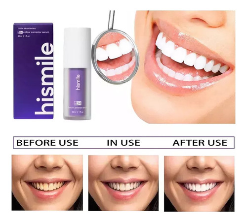 Et Crema Blanqueadora Dental Hi-smile V34/repair 4 Unidades