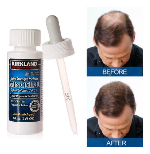 Kirkland Minoxidil 5% Tópico Kit 6 Unid + Obsequio