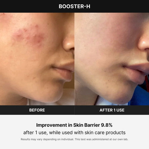 Dispositivo De Tratamento Facial Medicube Age-r Booster-h