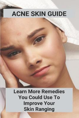 Libro Acne Skin Guide : Learn More Remedies You Could Use...