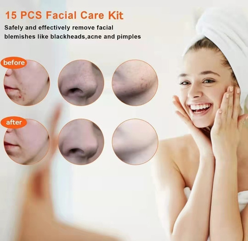 & Kit De Cuidados Com Acne Elimina Cravos E Espinhas 15