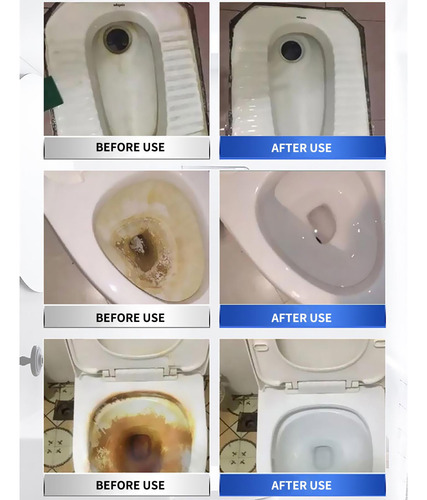 Agente De Oxígeno Activo U Toilet Shuwanjia Toilet Live Oxyg