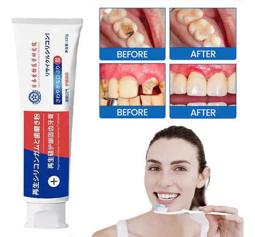 Reparo Rápido De Cáries Pasta De Dentes Para Cáries