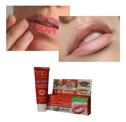 Balsamo Labial Para Labios Partidos Fresa