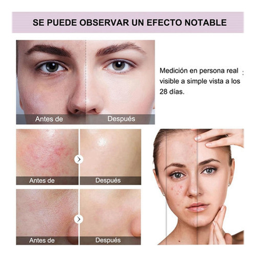 2pzs Serum The Ordinary Aha 30% Bha 2% Peeling Solution