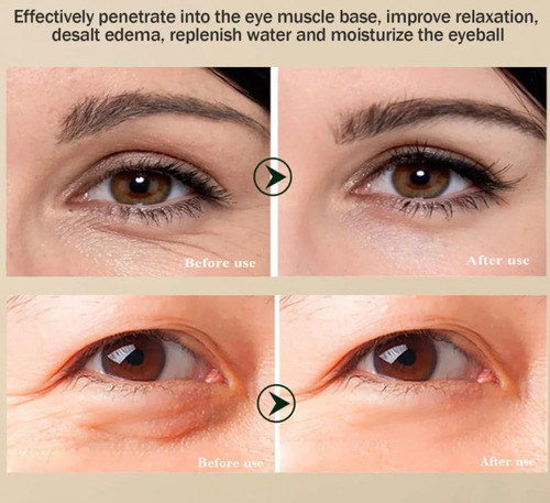 Creme De Olhos Reafirmante B Com Genciana Instant Slow Aging