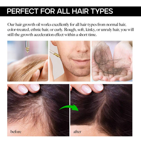 Sefudun Hair Serum 60ml Con Biotina Estimulante Para Cabello
