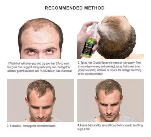 Tratamento De Calvície Cura Cabelo Calvo Freeshipping 3 Unid