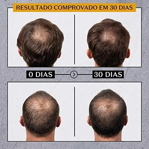 Combo Malbec Club Antiqueda: Shampoo + Tônico Capilar