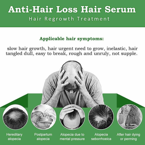 El Crecimiento Del Pelo En Suero, La Pérdida Del Cabello Y T