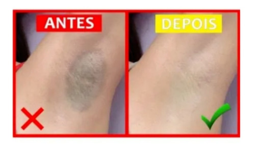 Pomada Micosan Pano Branco Para Micoses Em Geral 50g