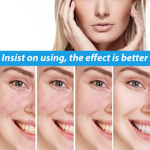 Nuturad Relief Brightening 30ml Repair Facial E Remoção Faci