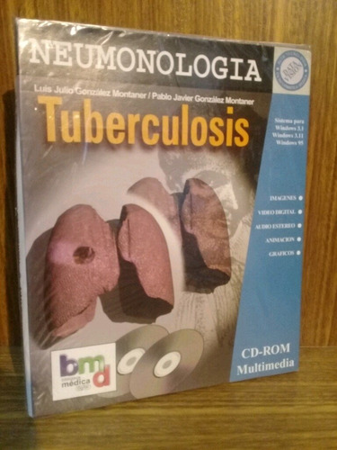 Cd Multimedia - Tuberculosis, Neumonología