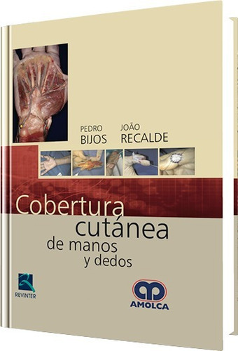 Cobertura Cutánea De Manos Y Dedos, De Pedro Bijos  João Recalde. Editorial Amolca, Tapa Dura En Español, 2015