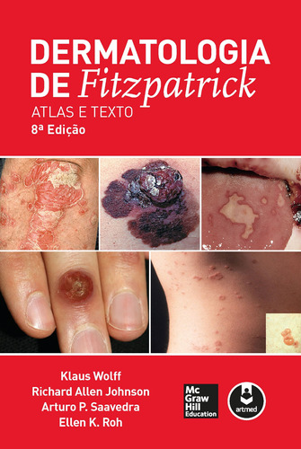 Dermatologia de Fitzpatrick: Atlas e Texto, de Wolff, Klaus. Editora AMGH EDITORA LTDA.,McGraw-Hill, capa mole em português, 2019