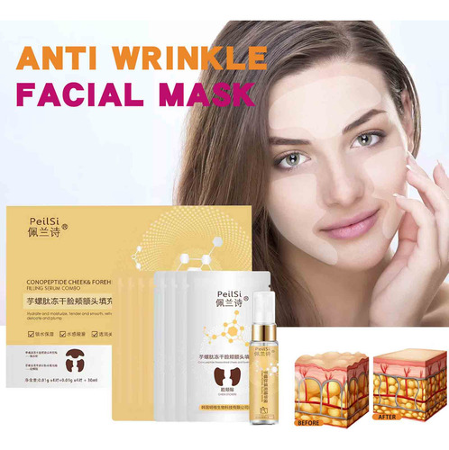 Parche De Relleno Instantáneo X Coniferin Nanometer, 30 Ml 7