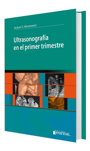 Ultrasonografía En El Primer Trimestre Abramowicz 