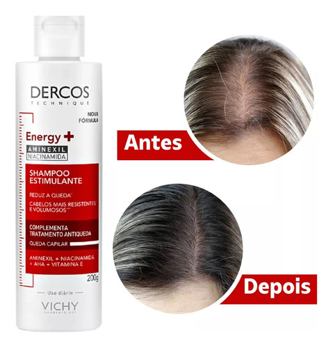  Shampoo Vichy Antiqueda Dercos Energizante Profissional