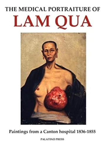 The Medical Portraiture Of Lam Qua: Paintings From A Canton Hospital, De Palatino Press. Editorial Createspace Independent Publishing Platform, Tapa Blanda En Inglés