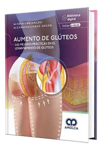 Aumento De Glúteos Las Mejores Prácticas En El Levantamiento de glúteos incluye e-book de Alvaro Cansancáo Vol. 1 Editorial Amolca Tapa Dura Edición 1 en Español 2024